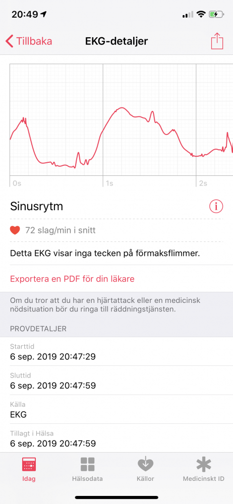 recension Apple Watch 4 EKG
